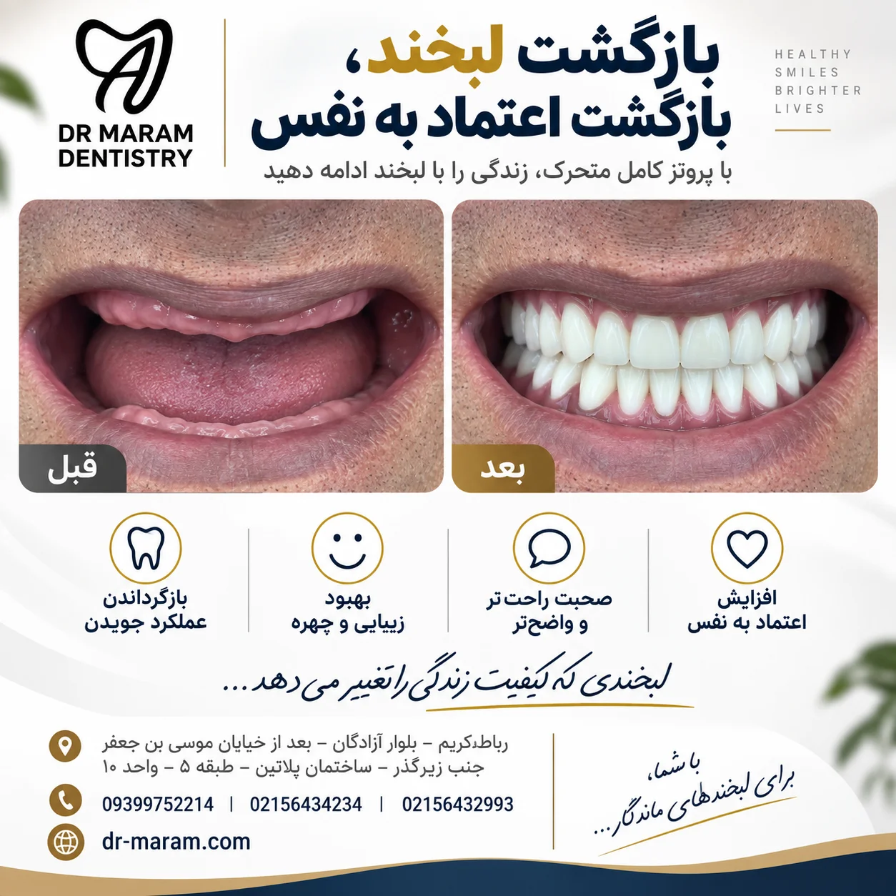 قبل و بعد از پروتز کامل متحرک در مرکز دکتر مرام
